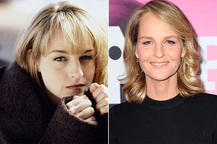 Helen Hunt Plastic Surgery Before and After Pictures 2024